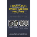 I Have a Beautiful Brain, Compared to the Brains of Alcoholics and Drug Addicts
