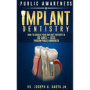 Public Awareness In Implant Dentistry: How To Double Your Implant Patients In 60 Days Or Less Through Public Awareness